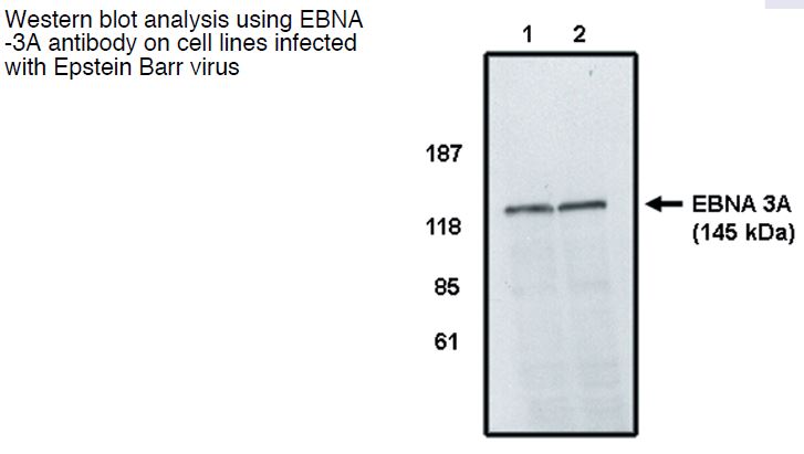 Figure 1. Western blot analysis using EBNA-3A anitbody on cell line infected with Epstein Barr virus.